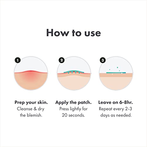 Mighty Patch Micropoint for Blemishes - Hydrocolloid Acne Spot Treatment for Early Stage and Deep Hidden Pimples (6 Patches)