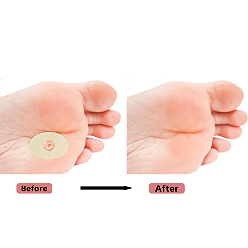 Bunion Plasters Corn Plasters Pads for Feet 30 Pcs Soft Corn Cushions Latex Foam Corn Plasters for Feet Self Adhesive Callus Pads Corn Pad Anti C