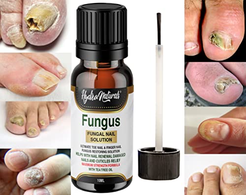 Hydra Naturals Nail Fungus Treatment, Nail Renewal - Maximum Strength Nail Care Solution for Finger & Toenail Fungus, Athlete's Foot, Ringworm by