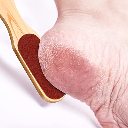 Eruinfang, Double Sided Wooden Foot Rasp File Foot Scraper Hard Skin Remover Foot Files for Wet Dry Cracked Feet Removing Dead Skin Foot Care, Bl