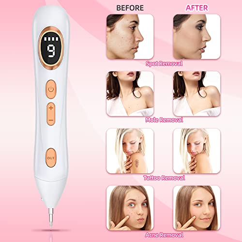 Augot Skin Tags Removal Pen, Professional Mole Remover Pen kit Portable USB Rechargeable Skin Tag Removal Pen with 9 Modes LCD Display Replaceabl