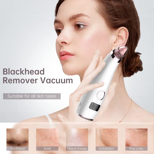 Blackhead Remover Vacuum Blackhead Remover Blackhead Extractor Pore Cleaner Black Head Remover Face Vacuum Pore Extractor - Includes Blackhead Re