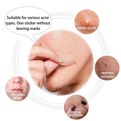 Hydrocolloid Acne Patch(20 Patches), Large Pimple Patch Spot Control Cover, Extra Larger Acne Patch for Covering Large Breakouts, Spot Patch, Pim