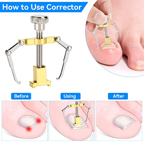 Aceshop Toenail Clippers Set, 15 Pcs Podiatrist Toenail Clippers Professional Toenail Clipper for Ingrown Thick Nails Heavy Duty Stainless Steel