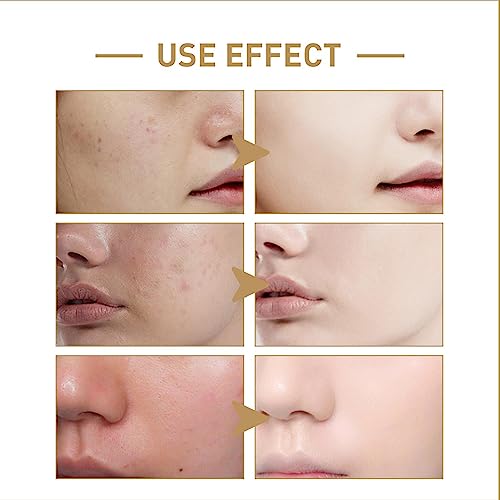 Rice Face Toner - 5.28fl oz Glow Boosting Essence, Rice Toner for Face, Natural Moisturizer Glow Essence, Hydrating and Moisturizing Rice Extract