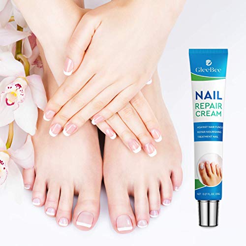 Fungal Nail Treatment, Fungus Nail Cream, Strong Anti-Fungal Toenail Cream, Nail Repair Nourishing Treatment, Restores Discolored and Damaged Nai
