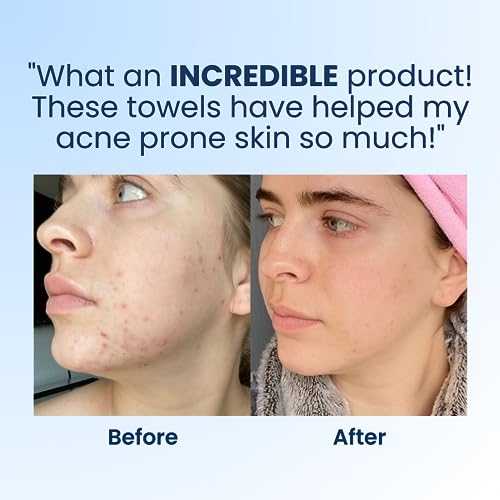 Clean Skin Club Clean Towels, 100% USDA Biobased Dermatologist Approved Face Towel, Disposable Clinically Tested Face Towelette, Facial Washcloth
