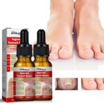 2PCS Ingrown Toenail Treatment,Nail Growth Treatment,Nail Helper Ingrown Toenail Drops,Toenail Correction Treatment Oil,Fungal Nail Treatment,Ing