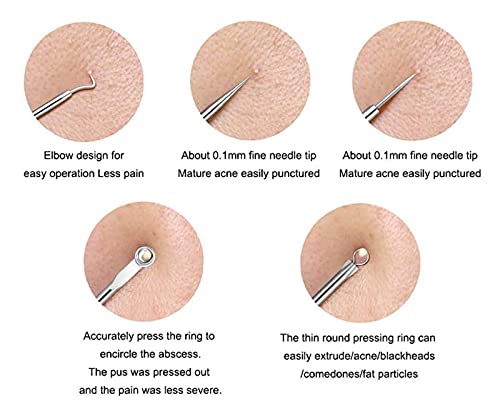 4PCS Blackhead removal tool kit. Four-piece with storage box for nose facial care silver