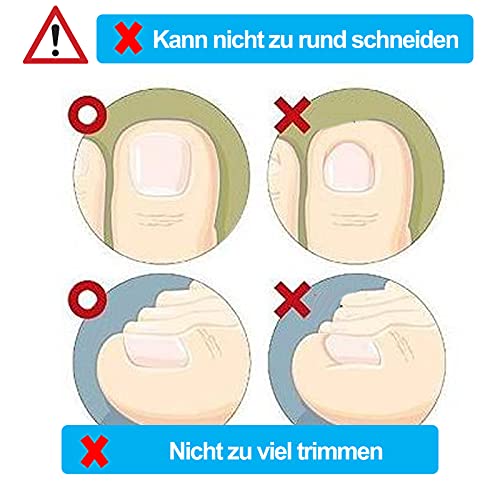 Ingrown Toenail Stick Patch, 4 Sizes Glue-free Toe Nail Correction File Patch Paronychia Corrector Foot Care Treatment Pedicure Tool Ingrown Toen