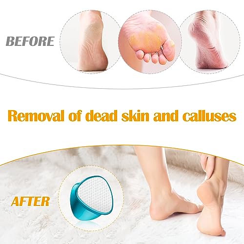 A3A ACADGQ Foot File - Double-Sided Nano Glass Callus Remover & Crystal Hair Eraser 2-in-1, Safe & Quick Callus Remover for Feet, Epilator for Wo