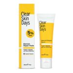 Clear Skin Days Blemish Treatment Cream - Overnight Spot & Acne Treatment for Face - with Salicylic Acid & Zinc - Calm Aggravated Skin, Treat Ble