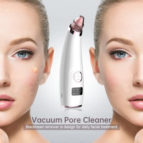 Blackhead Remover Vacuum Blackhead Remover Blackhead Extractor Pore Cleaner Black Head Remover Face Vacuum Pore Extractor - Includes Blackhead Re