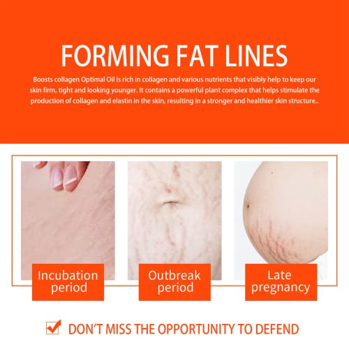 Optimal Oil - Collagen Boost Firming & Lifting Skincare Oil - Improves The Appearance Of Stretch Marks, Scars And Uneven Skin Tone (one-piece)