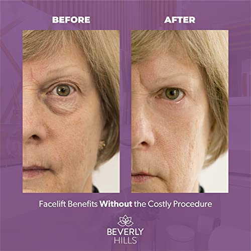 Beverly Hills Instant Facelift - Reduce Fine Lines and Remove Puffiness in 90 Seconds Rapid Reduction of Wrinkles, Instant Lift Eye Serum 30ml /