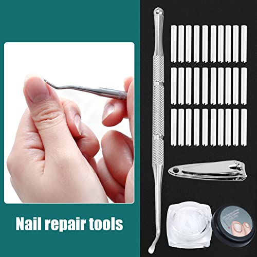 52 Pcs Ingrown Toenail Correction Strips Brace Kit, Ingrown Toenail Corrector Toenail Correction Patches Ingrown Toenail Treatment Toenail Straig