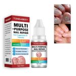 Fungal Nail Treatment,Nail Fungus Treatment For Toenail,Toe Nail Fungal Treatment,Toenail Fungus Treatment,Fungal Nail Treatment For Toenails Ext