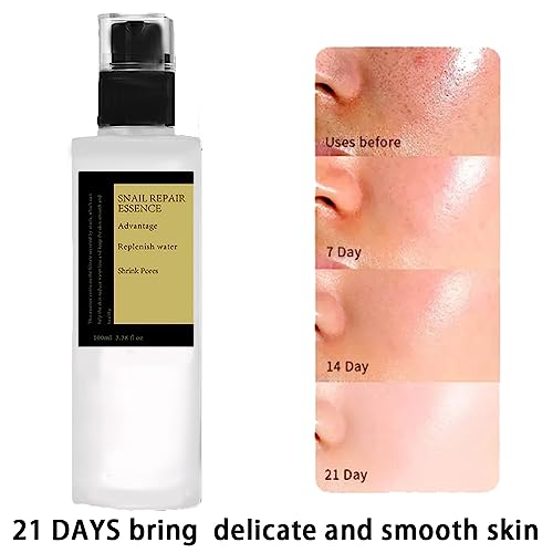 Snail Mucin Essence,Face Serum with Glow Recipe,Hydrating Hyaluronic Acid Serum for Face,Natural Niacinamide Serum,Skin Care,Man Polish Moisturis