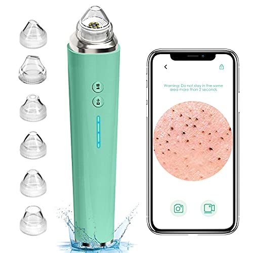 Blackhead Remover Pore Vacuum, Upgraded WIFI Visible Facial Pore Cleanser with HD Camera Pimple Acne Comedone Extractor Kit with 6 Suction Heads