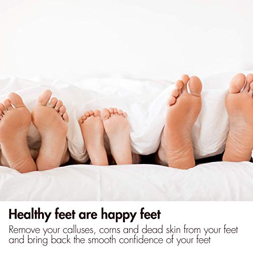 Revitale Natural Volcanic Lava Pumice Foot Stone - Pedicure Scrubber & Hard Dead Skin/Callus Remover (2 Pack)