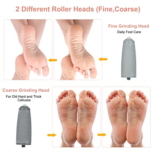 Pretfy Foot File, Electric Foot Callus Remover Rechargeable Pedicure Tool, 10 in 1 Electric Pedicure Feet Callus Remover Foot Care For Dead Skin