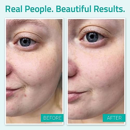 Pure Hyaluronic Acid Serum for Face, Hydrating Serum for Wrinkles, Dry Dull Skin & Dark Spot, Anti Aging Face Serum for Women & Men, Hyaluronic A