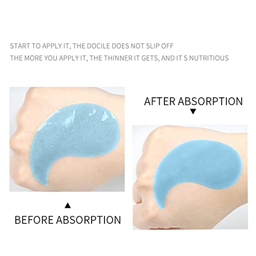 Hyaluronic Acid Under Eye Patches, Hydrate Eye Mask, Anti-aging, Improve Dark Circles, WrinkleReduction, Deep Hydration, Women's Eye Treatment Ma