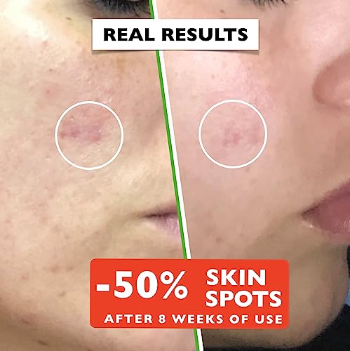 Big 2.11oz. Organic Vitamin C Serum for Face with Hyaluronic Acid. Anti-Aging, Wrinkles, Dark Spots, Brightening and Vegan Vitamin C Serum for Fa