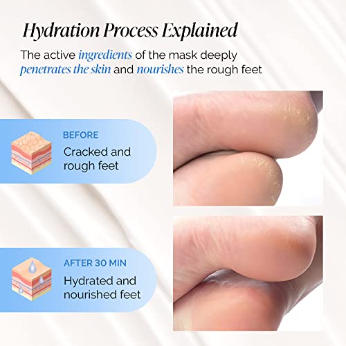 Hydrating Foot Mask for Dry & Cracked Feet - 2 Pack Hydrating Socks for Soft Heels - Intense Moisturizing and Repairing Dry Rough Skin - Foot Spa