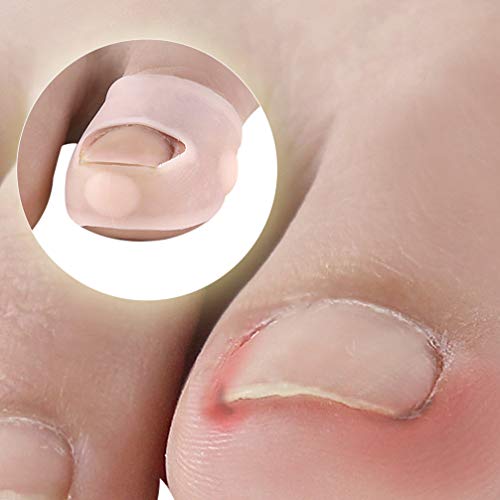 HEALLILY Ingrown Toenail Tool Toenail Corrector Patch Paronychia Toenail Treatment Tape Toenail Correction Sticker Paronychia Recover Foot Care T