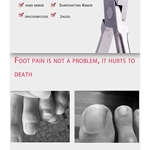 Cuticle Cutter Best Stainless Steel Pliers Scissors Suitable for Trimming Dead Skin on The Edges of Nails on Hands and feet Nail Art Tools Male F