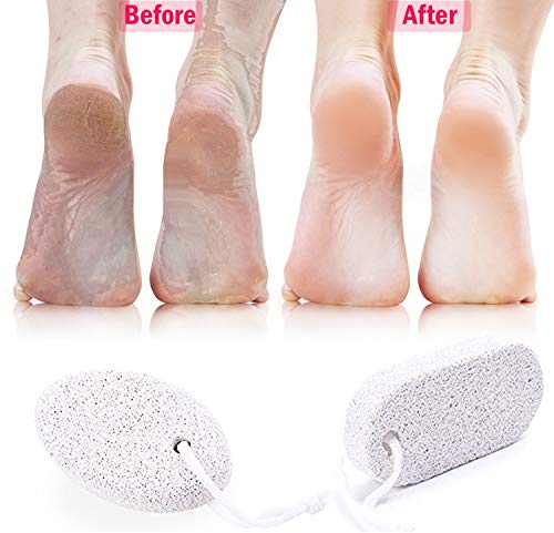 Pumice Stone for Feet 2 PCS Set_Foot Care Natural Pummice Stones for Dead Hard Skin_Foot Scrubber Calluses Removes_Gently Exfoliates Skin_Softer