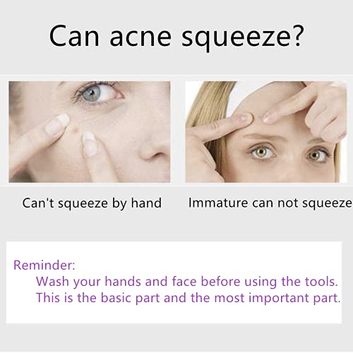 Color Blackhead Tool Kit, Stainless Steel Acne Needles Double Side Spot Squeezer Tool, Pimple Popper Tool Kit, Whitehead Removal (Colorful)