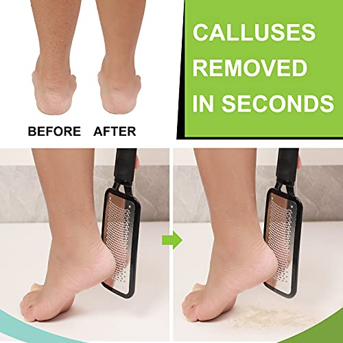 Colossal Pedicure Foot File, Dry Skin and Callus Remover, Hard Skin and Dead Skin Remover for Feet, Professional Stainless Steel at Home , for We