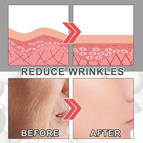 EELHOE Collagen Boost Anti Aging Serum, Anti-Aging Serum, Anti-Wrinkle Face Serum Fade Microgroove, Blemish Skin Corrector Serum, Dark Spot Corre