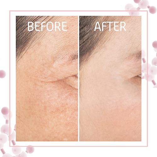 Retinol Serum 30ml, -64% Wrinkles in 3 Months - Retinol Serum High Strength for Face - Collagen Booster for a Natural Face Lift - Clinically Test