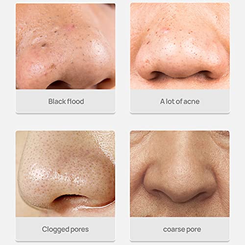 for lanbenas pore strips, for lanbenas blackhead remover, black head remover for nose, for lanbenas nose plants pore strips, Gifts