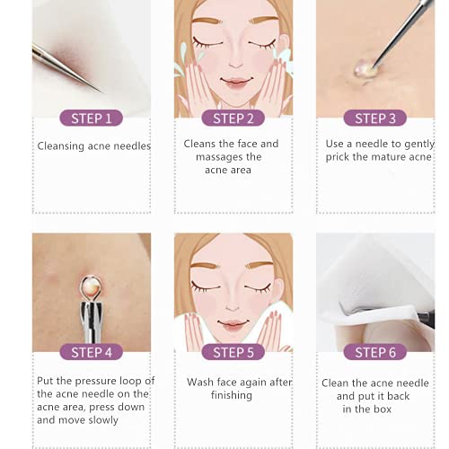 Color Blackhead Tool Kit, Stainless Steel Acne Needles Double Side Spot Squeezer Tool, Pimple Popper Tool Kit, Whitehead Removal (Colorful)