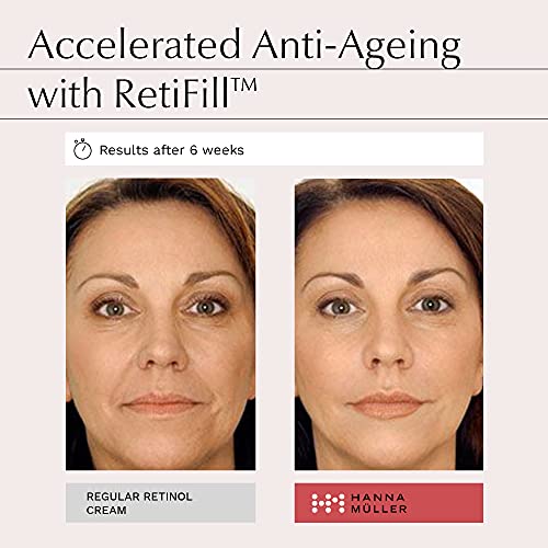 Organic Anti Aging Retinol Face Cream 1% Retinaldehyde in Squalane - Firming Day & Night Retinol Cream For Women & Men with Aloe Vera, Vitamin E