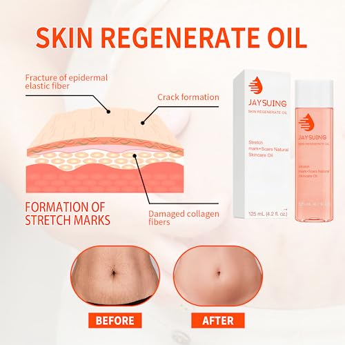 Optimal Oil - Collagen Boost Firming & Lifting Skincare Oil - Improves The Appearance Of Stretch Marks, Scars And Uneven Skin Tone (one-piece)