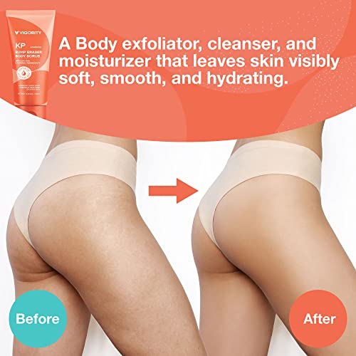 KP Bump Eraser Body Scrub, Body Exfoliating Scrub, Strawberry Legs Treatment, Exfoliating Body Wash, Strawberry Skin Treatment, Scrubs for Women
