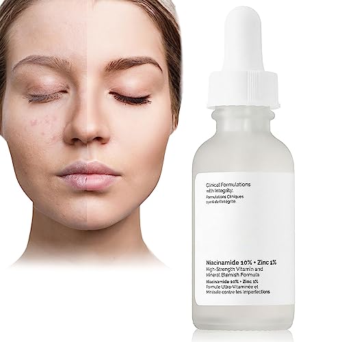 Niacinamide10%+Zinc 1%,Tackles Blemishes, Pore Reducer Face Serum,Minimises Pore, Brightening Serum for Blemish-Prone,Dull Skin, Softens & Bright