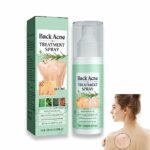 Back Acne Treatment Spray, Lighten Acne Marks Skin Care Spray, Herbaluxy Back Acne, Repair Back Shoulder Acne & Body Acne & Chest Acne & Butt Acn