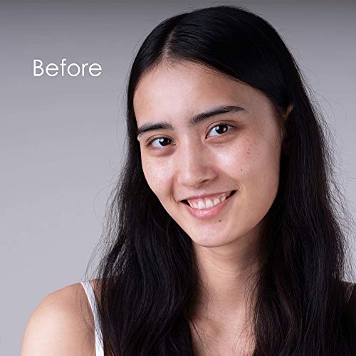 Nature Spell Brown Sugar & Coffee Face Scrub Exfoliator 100 ml – Natural Coffee Scrub Exfoliates Dead Skin Cells, Reduces Inflammation, Softer &