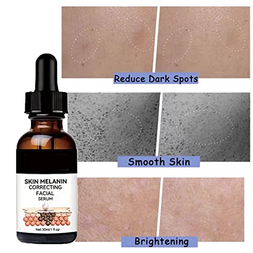 Dark Spots Correcting Facial Serum,Brightening Facial Serum,Rapid Dark Spot Correcting Serum,Improve Dry Skin & Smooth Skin,Brightening Serum,Dar