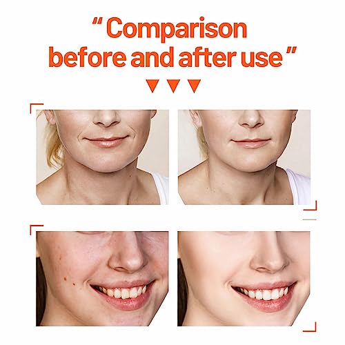 mercham Skincare Set Gifts for Teenage Girls-Vitamin C Serum for Womens Gift Sets, Includes Cleanser-Toner-Serum-Face Cream, Moisturizing & Brigh