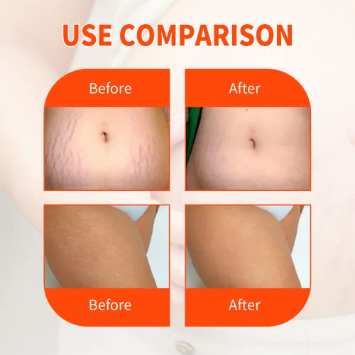 Optimal Oil - Collagen Boost Firming & Lifting Skincare Oil - Improves The Appearance Of Stretch Marks, Scars And Uneven Skin Tone (one-piece)