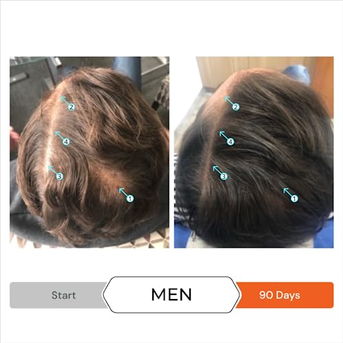 DS LABORATORIES Revita High Performance Hair Stimulating Shampoo 205 Milliliter Anti-Hair Loss