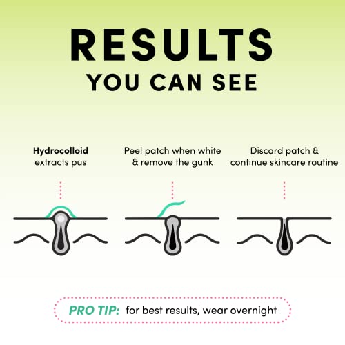 Dots for Spots Acne Patches - Pack of 60 Translucent Hydrocolloid Pimple Patch Spot Treatment Stickers for Face and Body - Fast-Acting, Vegan & C