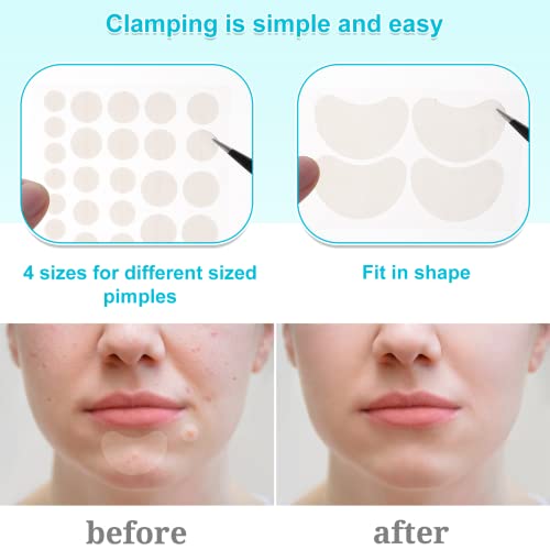 Heyu-Lotus 248 PCS Pimple Patches, Invisible Blemish Hydrocolloid Spot Patches Essential Oil Spot Cover, Acne Stickers Spot Stickers Effective Pi